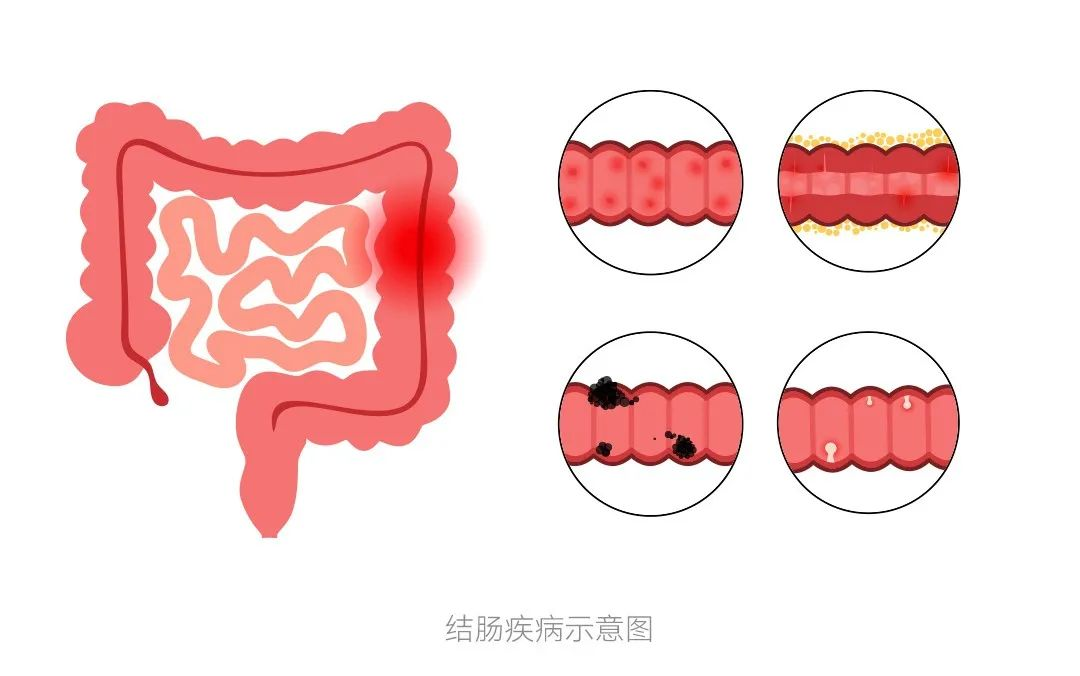 圖片.png 圖片.png